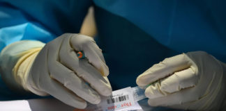 coronavirus, covid-19